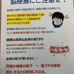 暑い季節は脳梗塞に注意しましょう